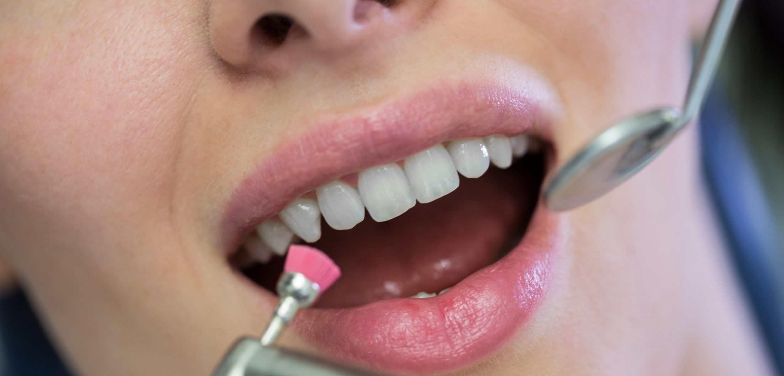 Dentist examining a female patient with tools at dental clinic